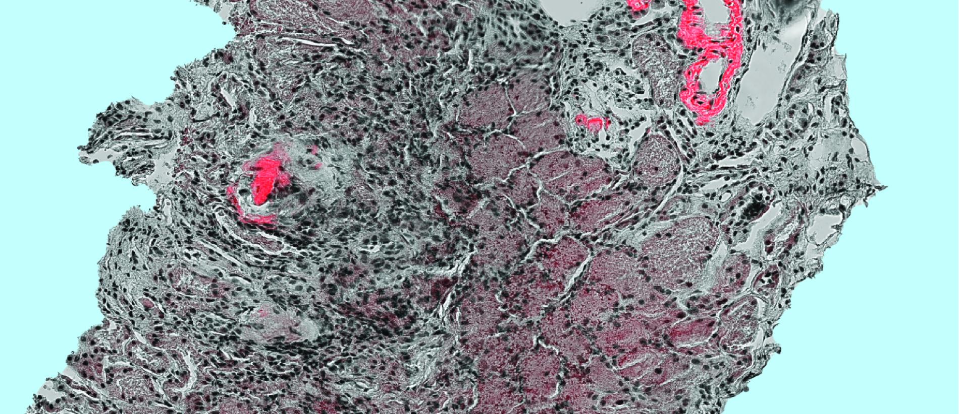 Campaign Image ProAgg24 VIB Conferences C Image by Nikky Courthout Meine Ramakers and Katerina Konstantoulea VIB Labs lr 2